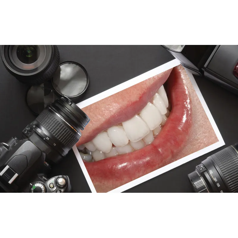 Dental Photo Set – Camera & Ring Light - 2