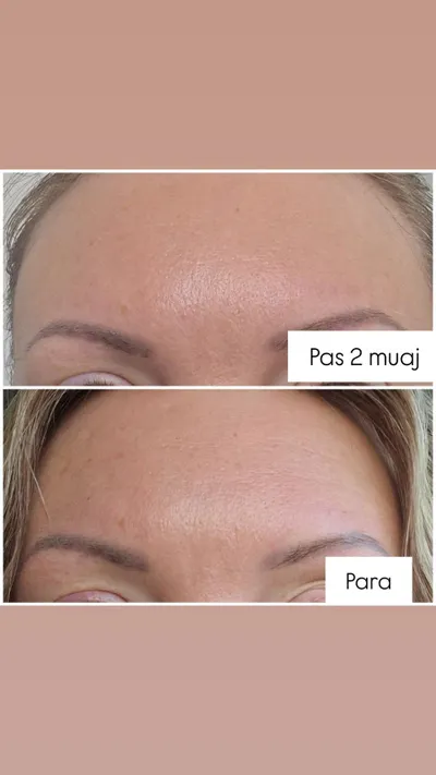 Serum për rrudha The Ordinary Argireline Solution 10%, 30ml - 3