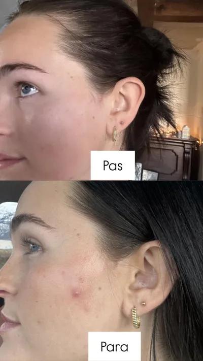 Serum për fytyrë kundër rrudhave The Ordinary Retinol 0.5% in Squalane, 30ml - 4