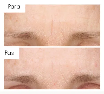 Serum për fytyrë kundër rrudhave The Ordinary Retinol 0.5% in Squalane, 30ml - 6