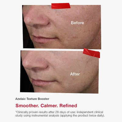 Serum për fytyrë SkinCode Essentials Azelaic Texture Booster, 30ml - 6