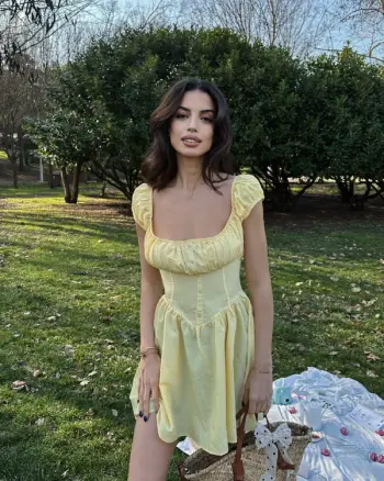 Fustan i Shkurtë ngjyre të Verdhe – Elegancë dhe Freski për Çdo Moment