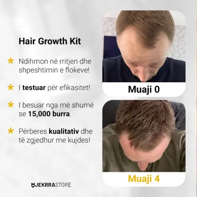 Set për flokë Mansera Serum Minoxidil 5%, 50ml + aplikator smart - 2