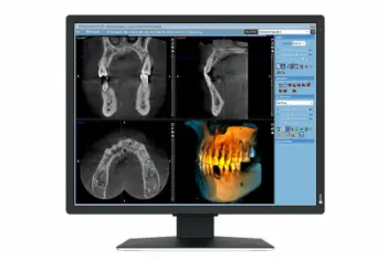 Monitor profesional EIZO RadiForce MX217 SB, 21", IPS, i bardhë