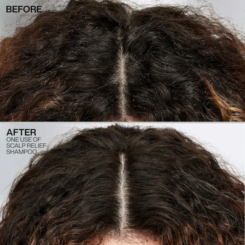 Redken Dandruff Control Shampoo - 2